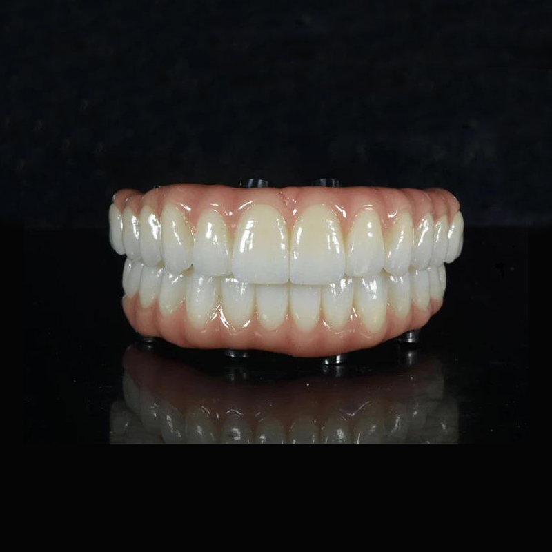 ALL-ON -X ZIRCONIA BRO