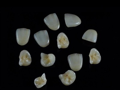 Hur man väljer det bästa tandlimmet för kronor: En senaste guide