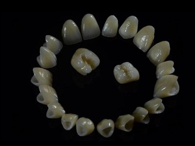 Dental Lab Zirconia Crowns: kvalitet, process och vad man ska leta efter i et...