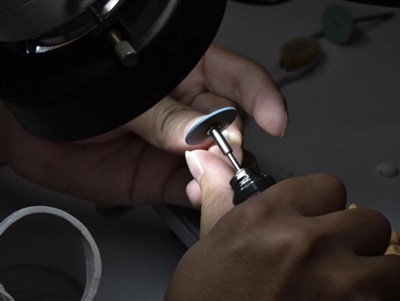 Hur länge håller PFM-kronor? Genomsnittlig livslängd, faktorer och vårdtips