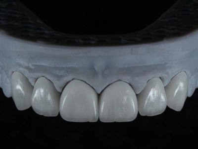 Hur man lägger ut tandlaboratoriearbete utomlands: En omfattande guide